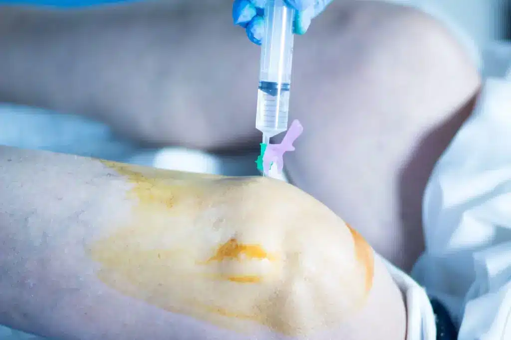 Bone Marrow Transplant Survival Rate By Age: The Facts