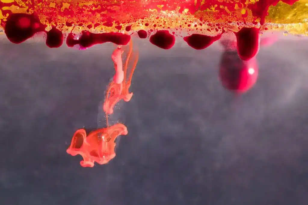 Hemoglobinuria: Is This Rare Condition Hereditary?