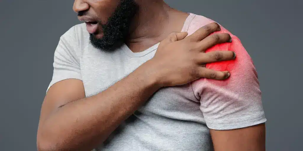 Thrombocytopenic Purpura: Scary Child Bruises