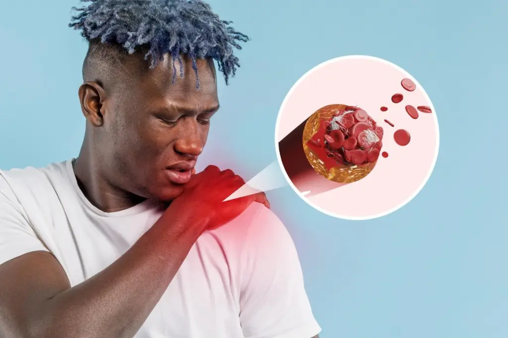 Polycythemia: Spot These Scary Early Symptoms