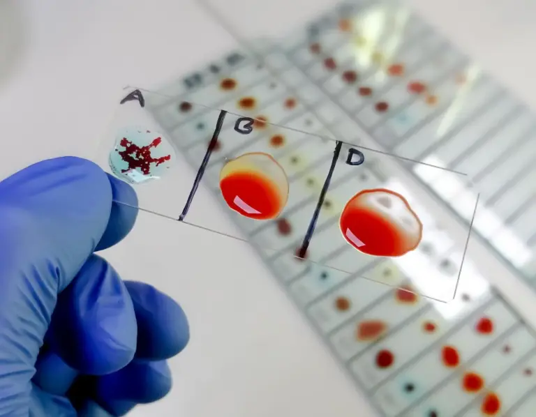 Polycythemia Confusion: Avoid Scary Mistakes