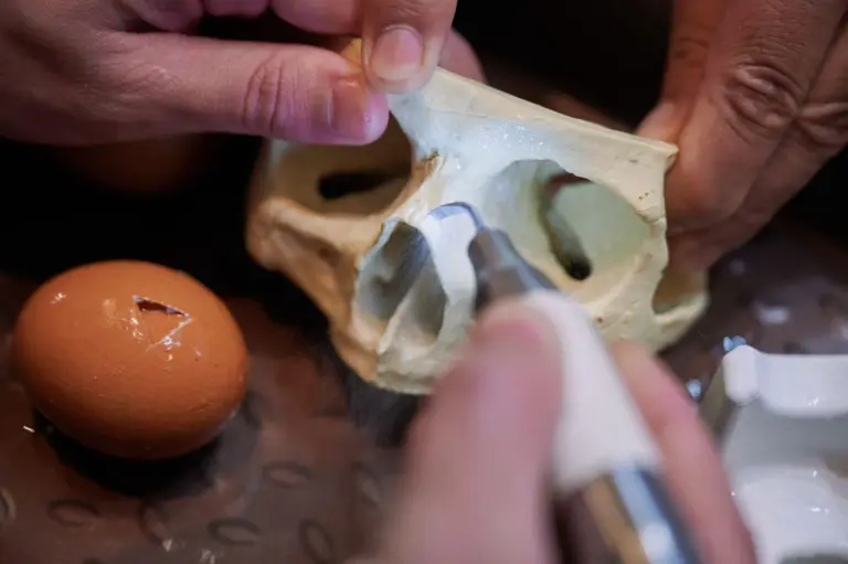 Bm Transplantation: Factors That Sadly Disqualify You