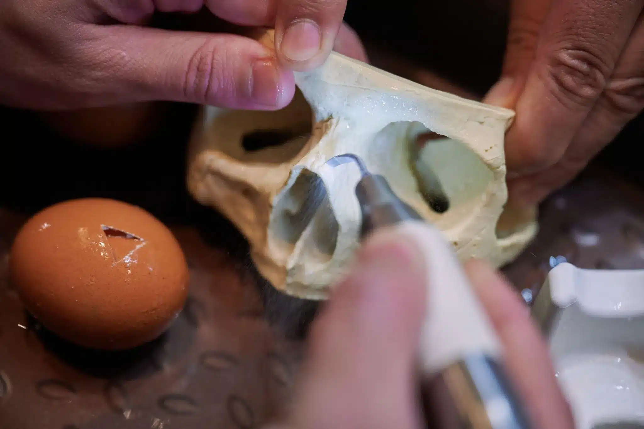 Bm Transplantation: Factors That Sadly Disqualify You