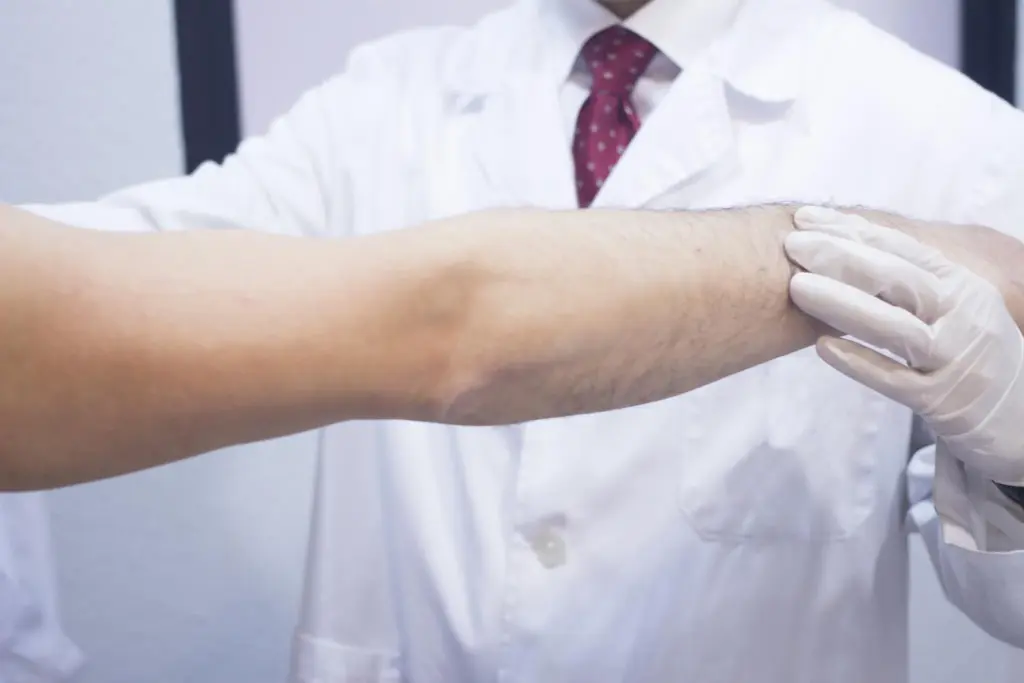 Best Exercise For Anemic Person: Amazing Benefits