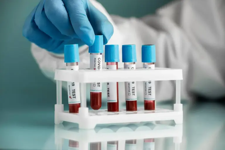 Fasting For Blood Work: Avoid Scary Errors