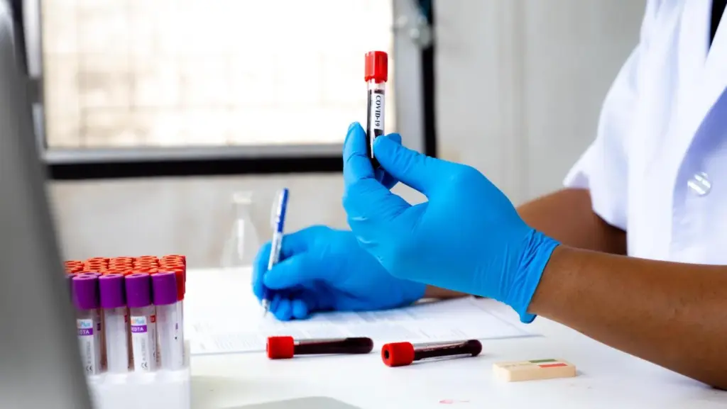 Fasting for Blood Work: Requirements and Importance