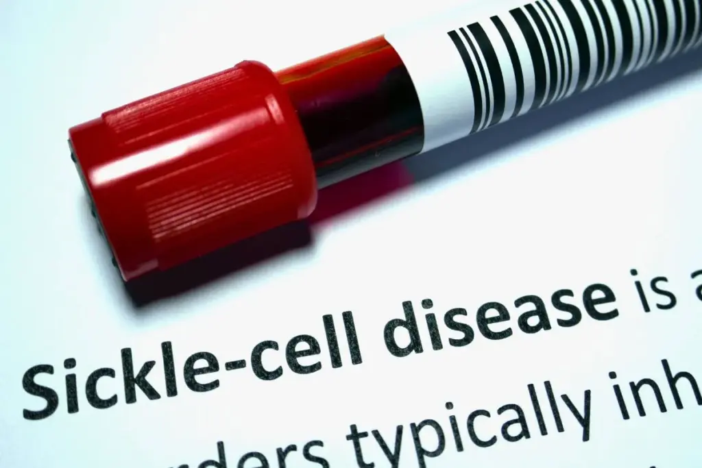 Oxbryta: The Powerful New Sickle Cell Treatment