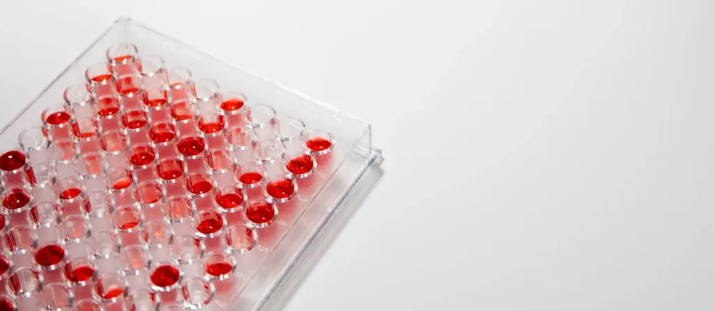 Blood Cell Production and MDS