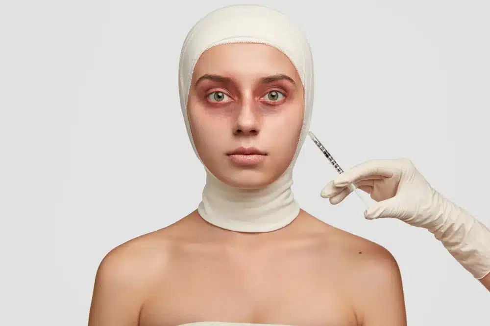 Thrombocytopenia: A Primary Cause of Red Spots