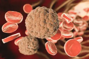 What Is Mds? The Scary Link To Multiple Myeloma