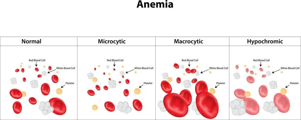 What Type Of Cancer Causes Low Hemoglobin?