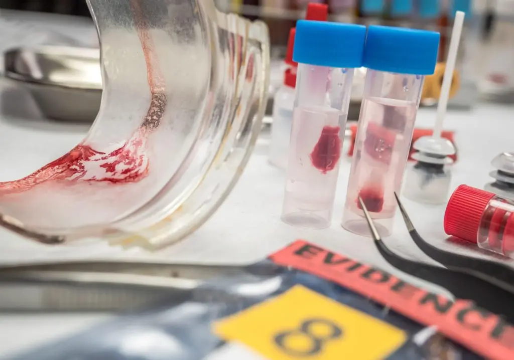 Genetic Basis of Paroxysmal Nocturnal Hemoglobinuria