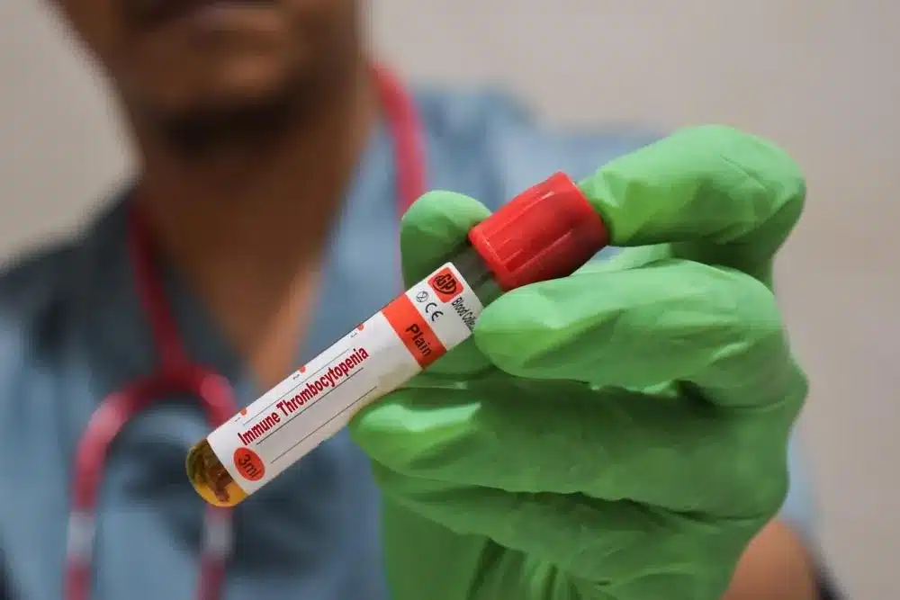 Understanding Thin Blood and Thrombocytopenia