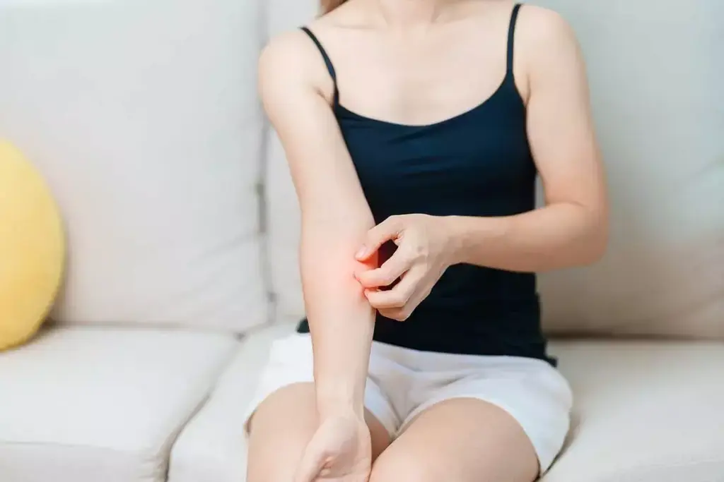 Understanding Allergic Reactions and Their Impact