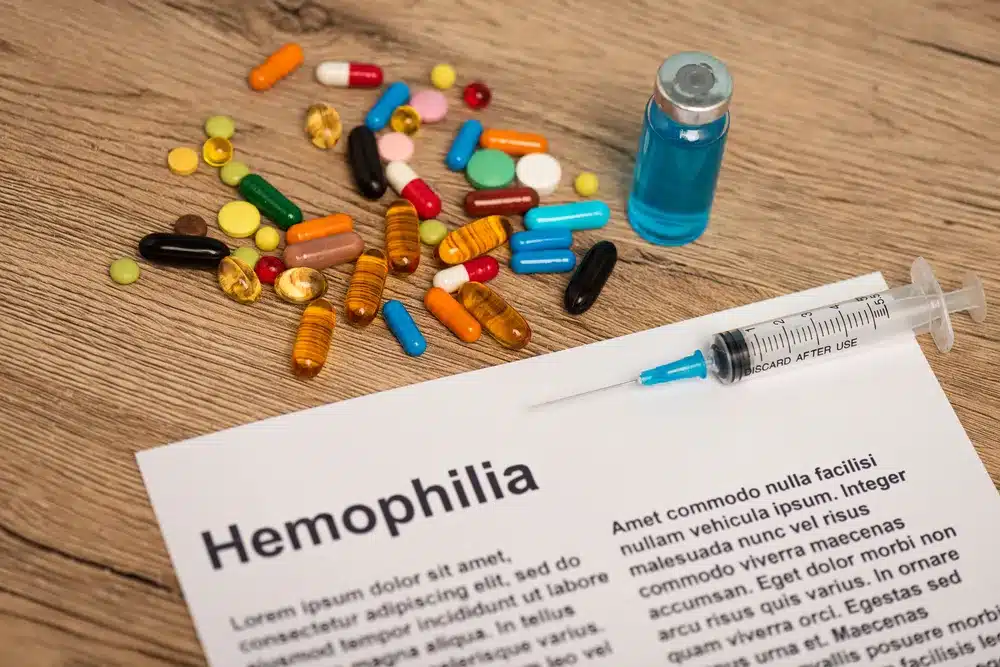 Hemophilia A: Factor VIII Deficiency