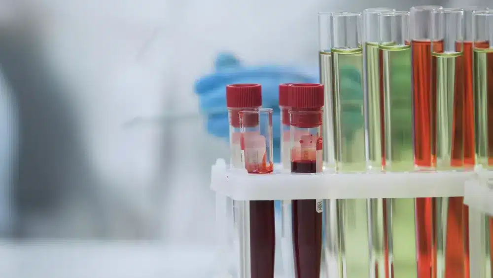 SEP 16547 image 7 LIV Hospital