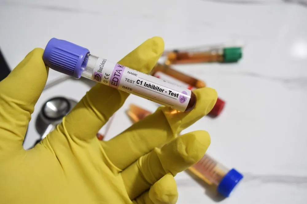 SEP 16547 image 6 LIV Hospital