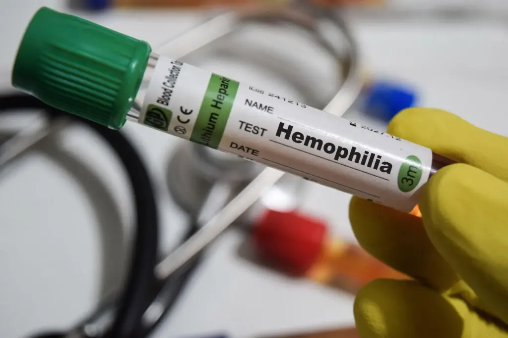 Definition Of Hemophilia Disease: Daily Impacts 2 The Genetics Behind Hemophilia: Inheritance Patterns