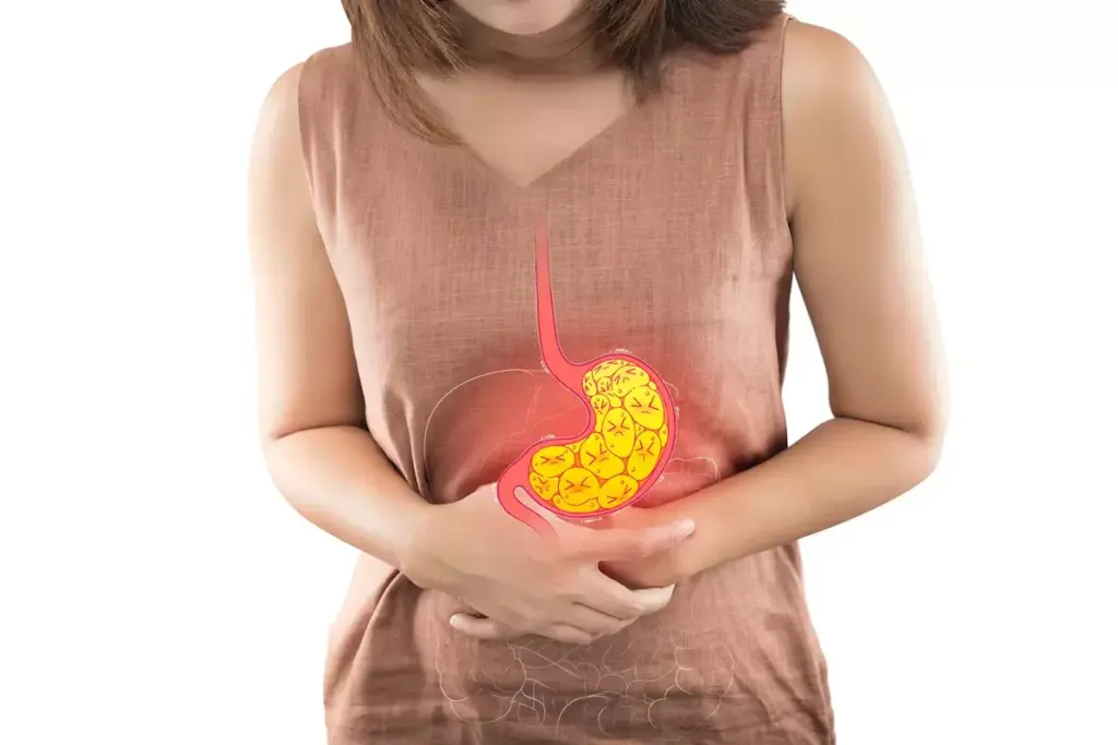 The Link Between Acid Reflux and Breathing Difficulties