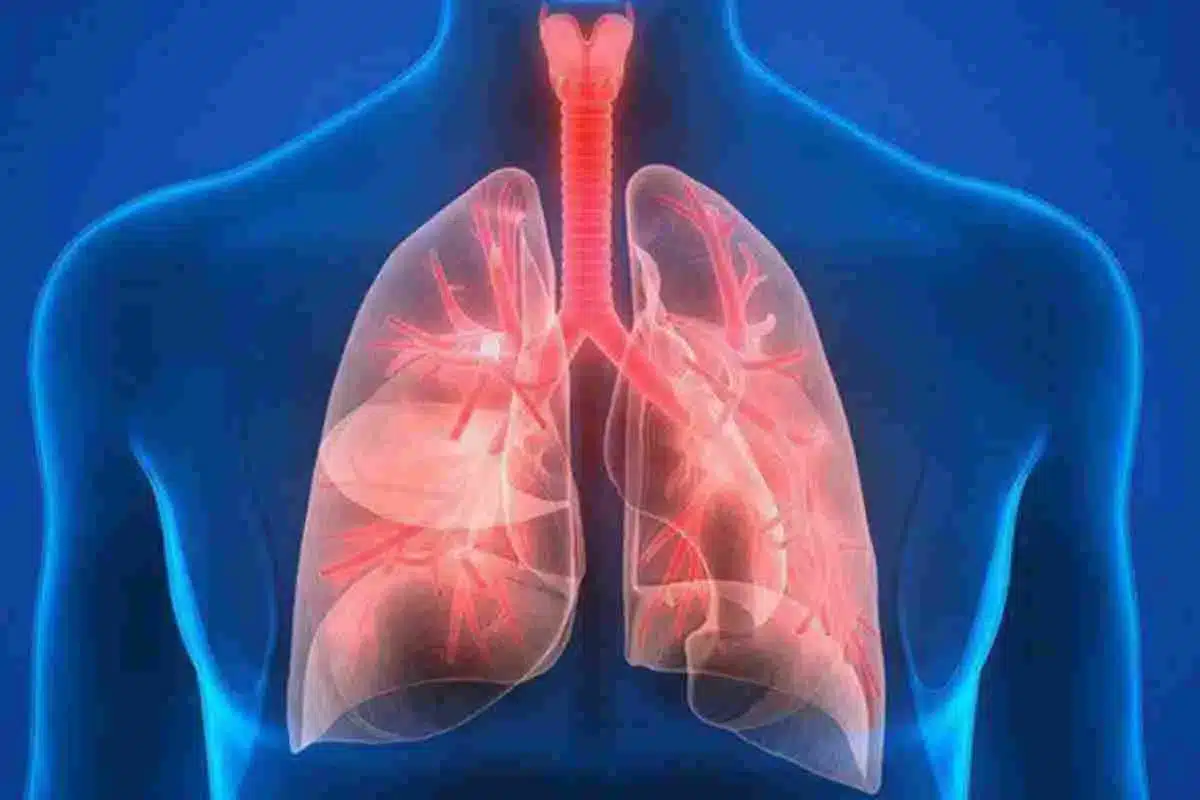 What Are Stage 4 Pulmonary Fibrosis Symptoms and Life Expectancy?