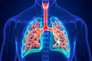 What Is Pleurisy? Understanding Lung Lining Inflammation and Chest Pain