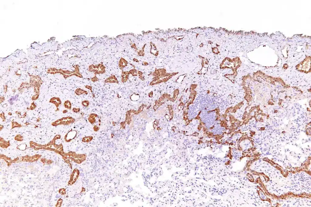 Prognosis and Life Expectancy Factors