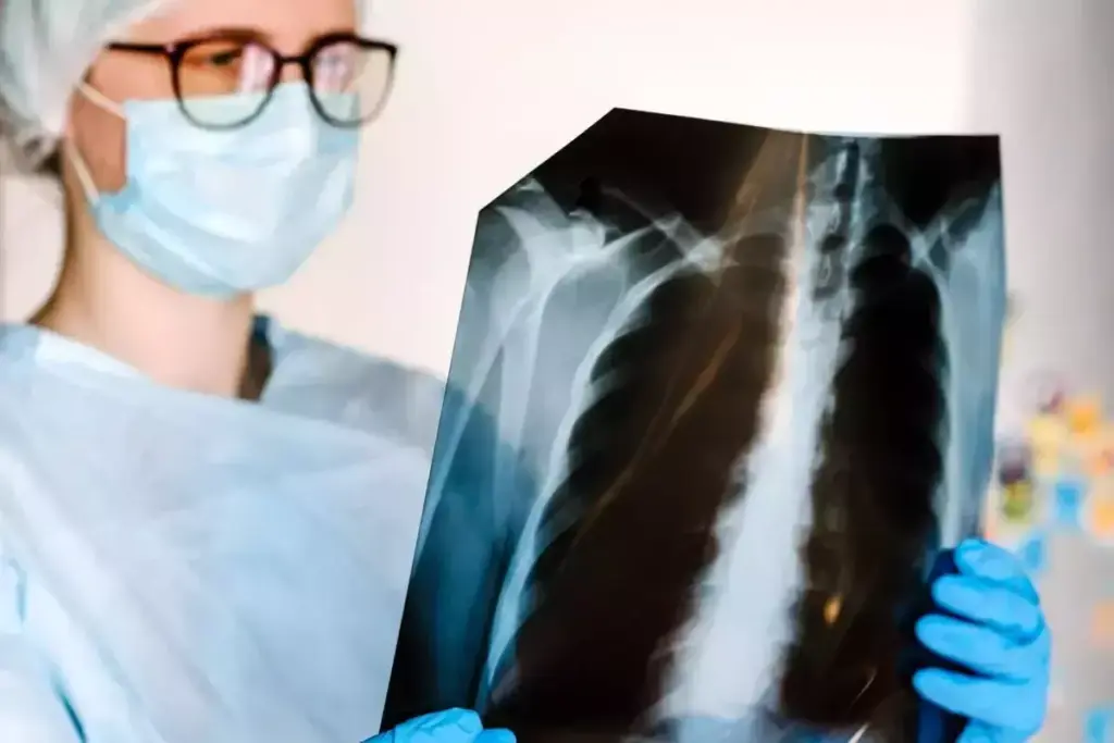 Does COPD Show Up on an X-Ray? What Imaging Reveals 3 Limitations: Does COPD Show Up on X-Ray in All Cases?