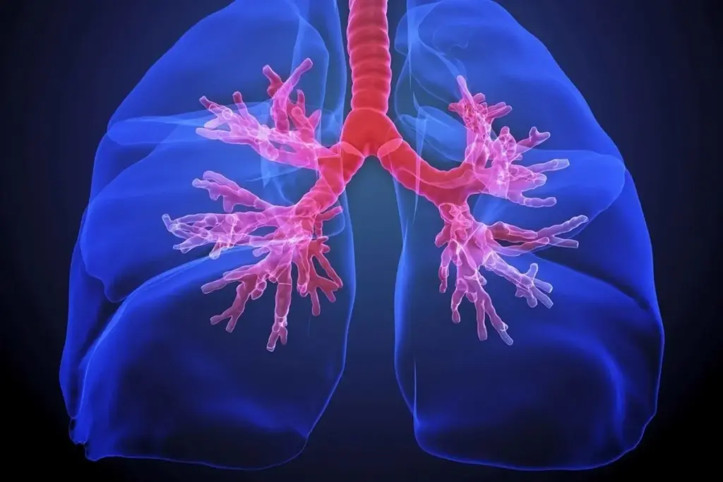 Is Bronchiectasis Obstructive or Restrictive? Understanding Lung Disease Classification
