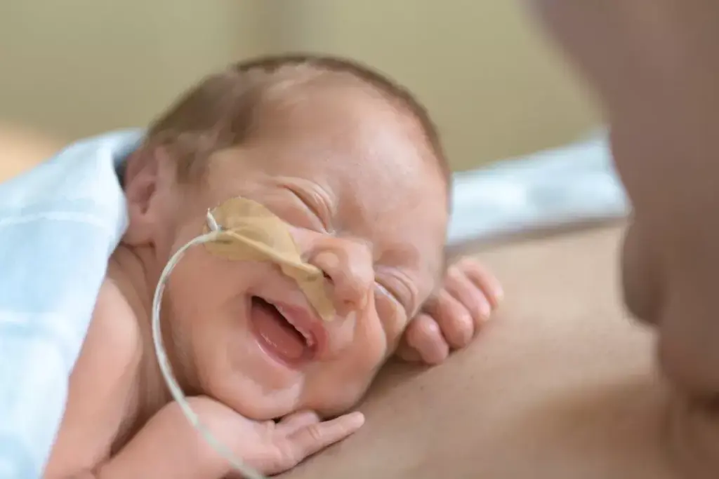Understanding Laryngomalacia in Newborns