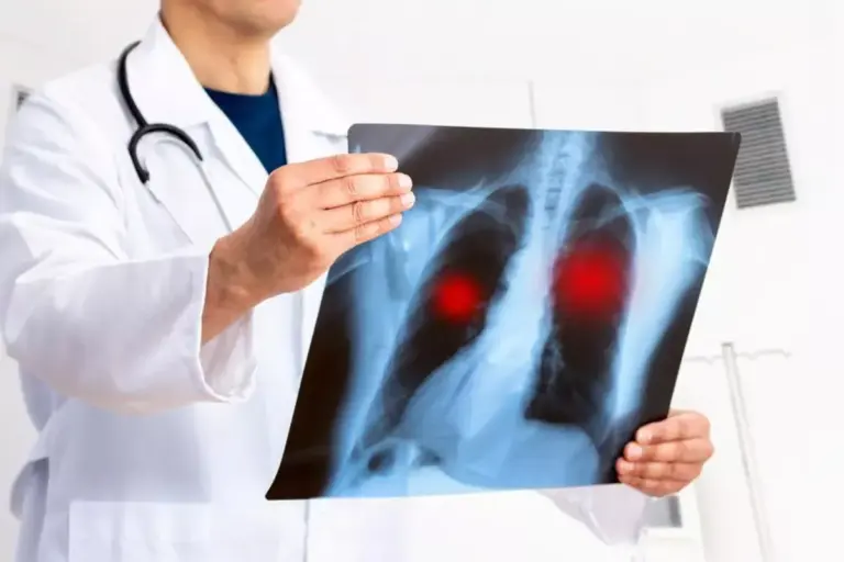How to Recognize Pneumoconiosis Symptoms