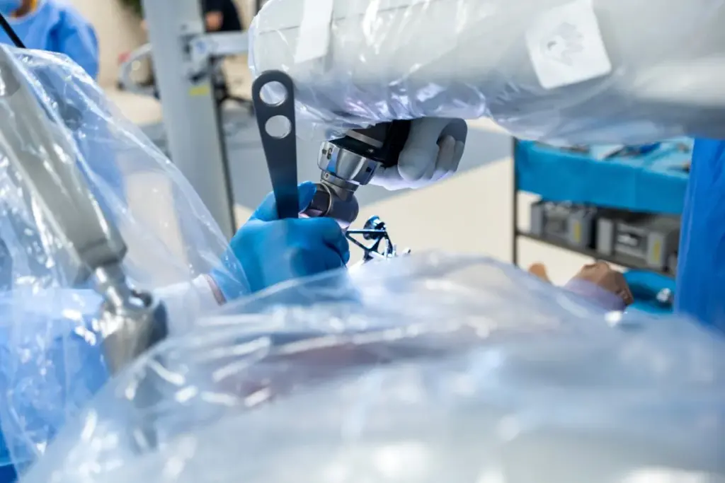 Understanding Robotic Surgery: A Modern Approach