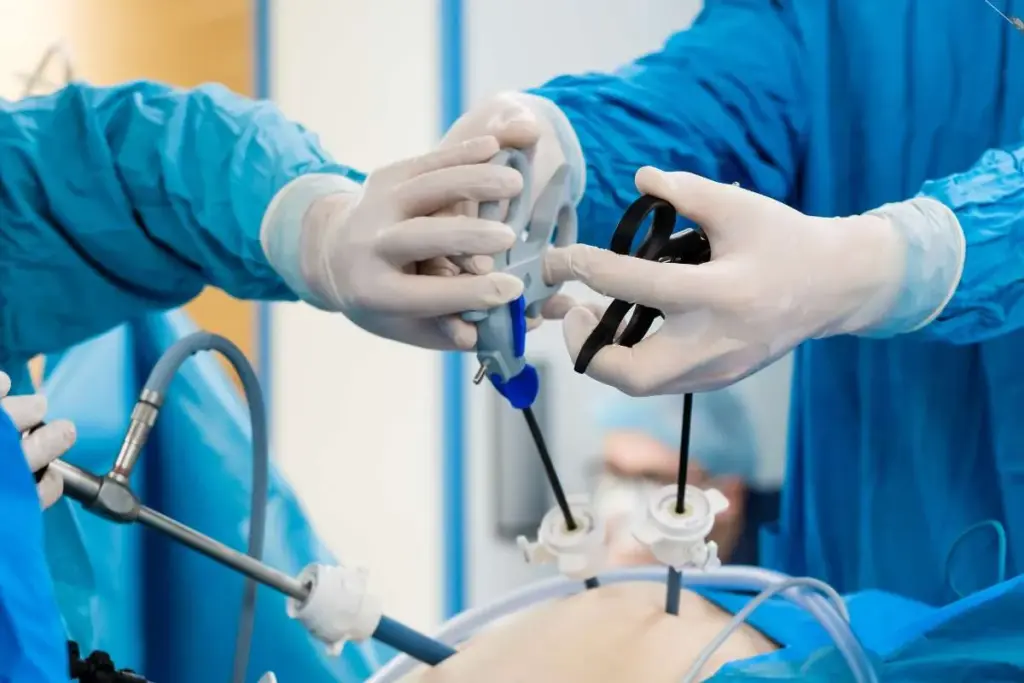 Bowel Resection: What Happens When Part of Your Intestine is Removed