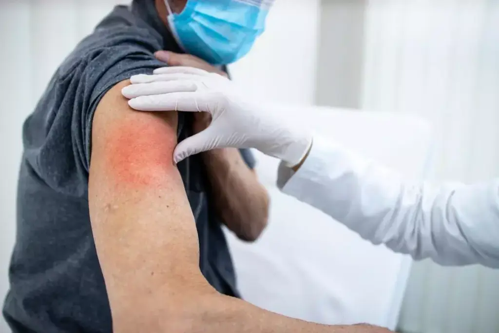 Long-Term Side Effects of Allergy Shots