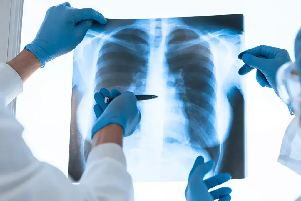 Does a Chest X-Ray Show Asthma? What You Need to Know 2 Does a Chest X-Ray Show Asthma? Understanding the Limitations