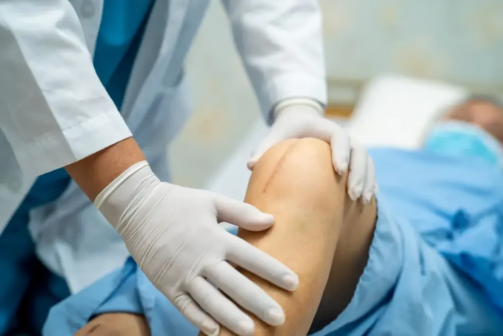 Understanding Knee Replacement Surgery