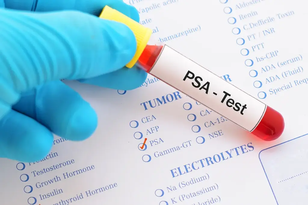 Understanding PSA Testing and Its Purpose
