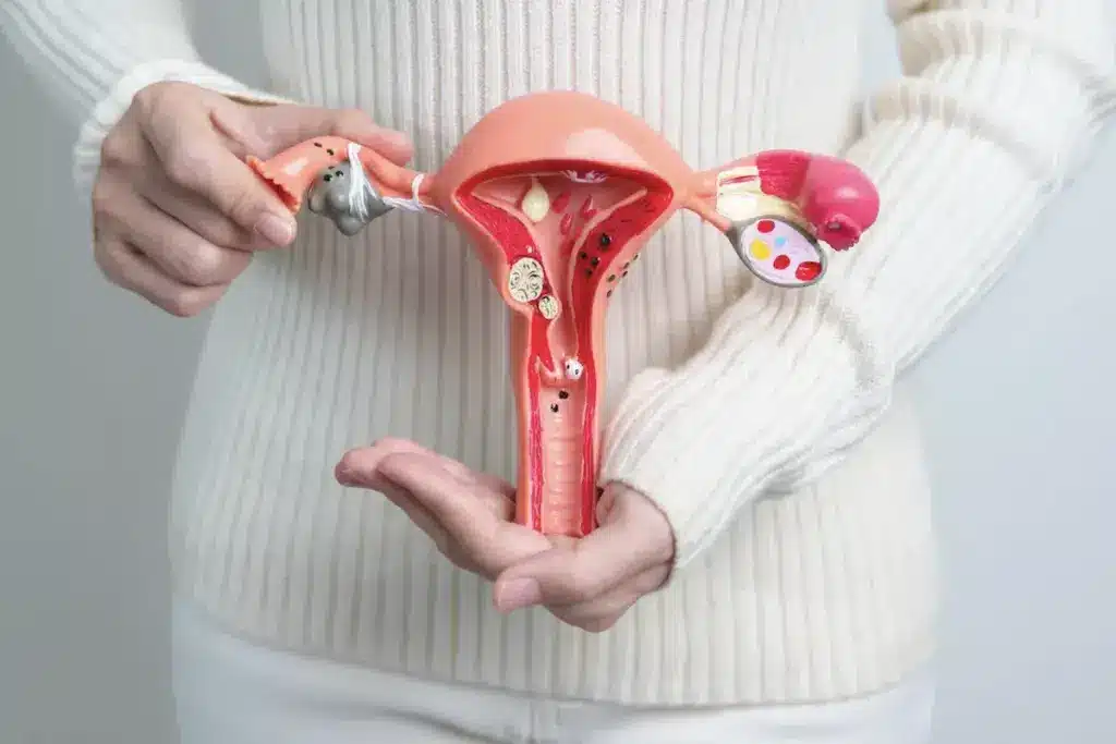 Laparoscopic Hysterectomy: Best Amazing Care 1 Laparoscopic Hysterectomy: Best Amazing Care