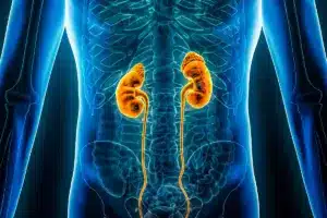 Nephrectomy: Best Amazing Mass Size Criteria