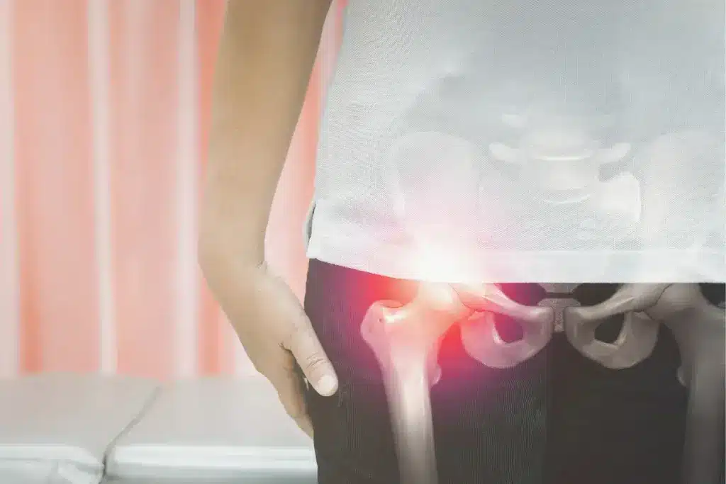 Hip Operation Complications: Vital Safety Guide