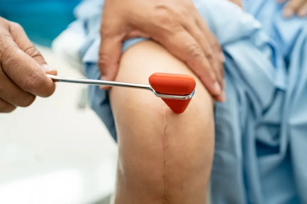 Recovery Time From Tkr: Best Success Guide