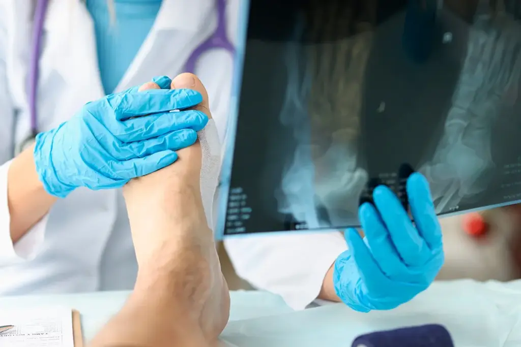 Foot Surgery: Essential Safety And Comfort