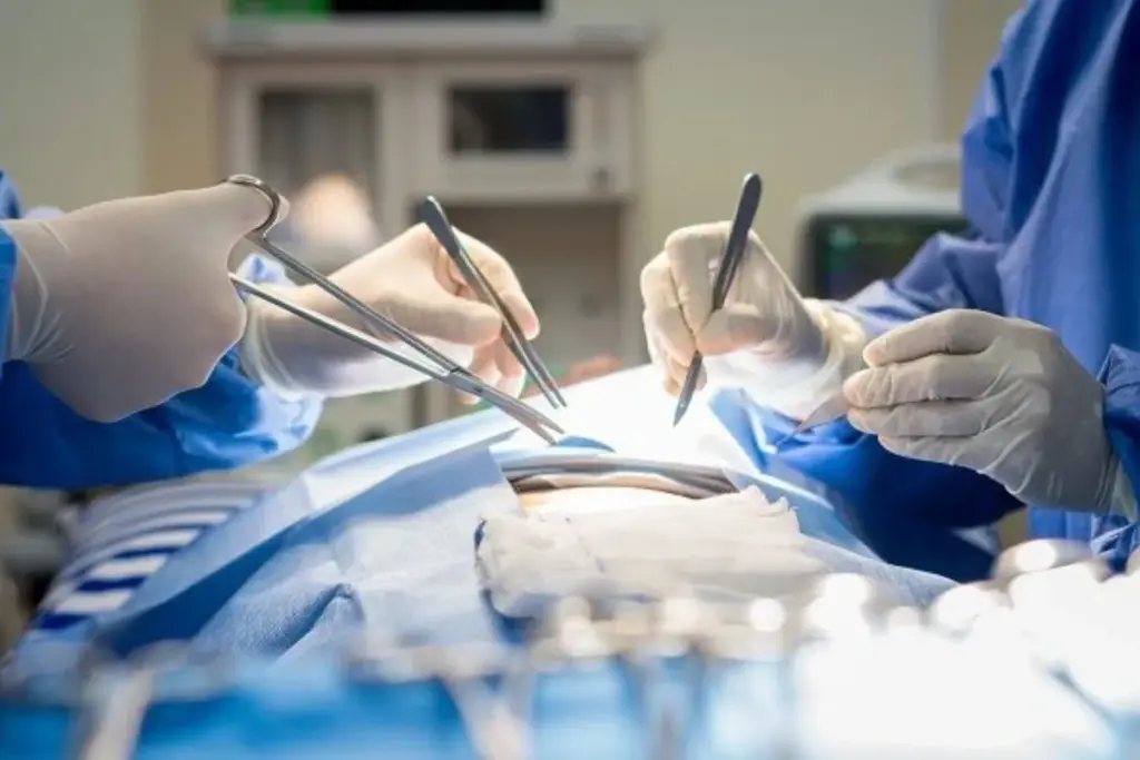 Aortic Rupture Risks: Vital Surgery Facts