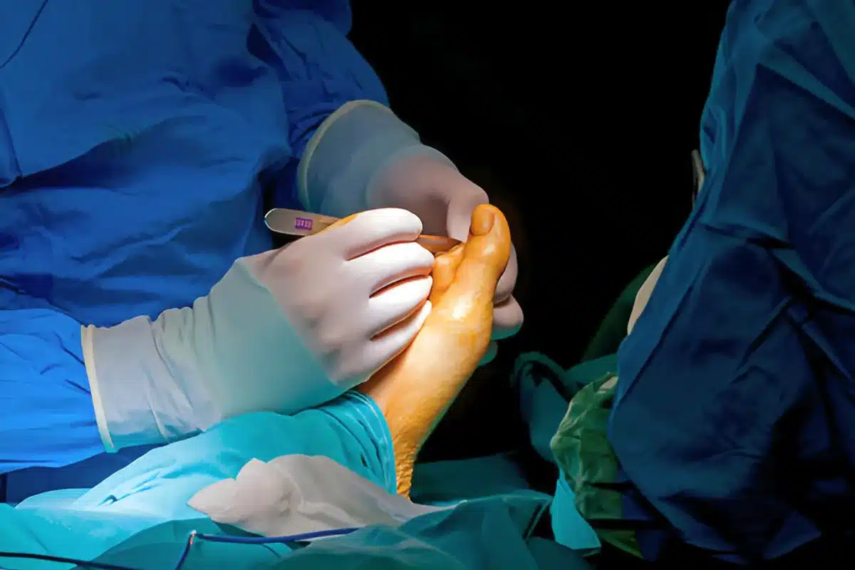 Orif Surgery: Amazing Guide To Bone Healing