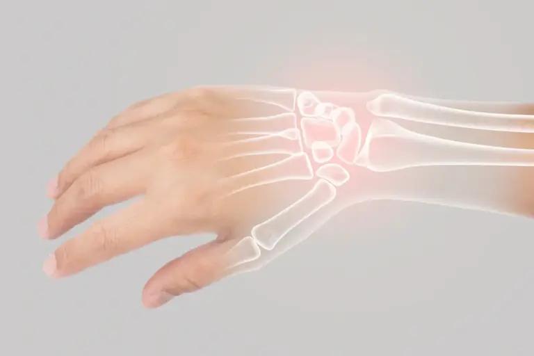 Wrist Pain: Amazing Ways To End Agony Now