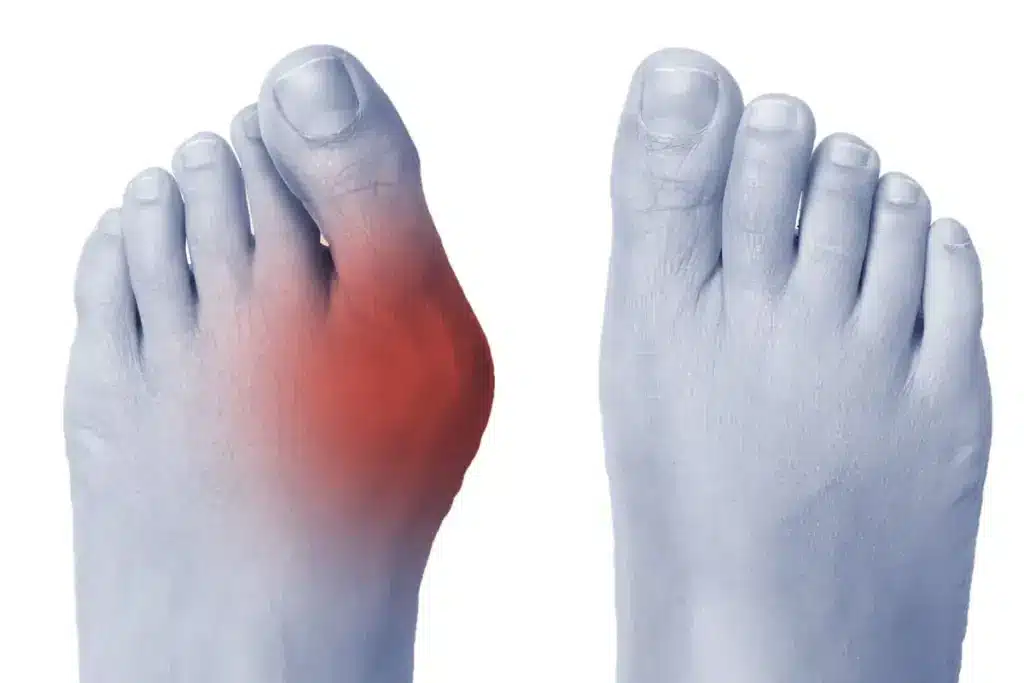 Types of Foot Pain Specialists
