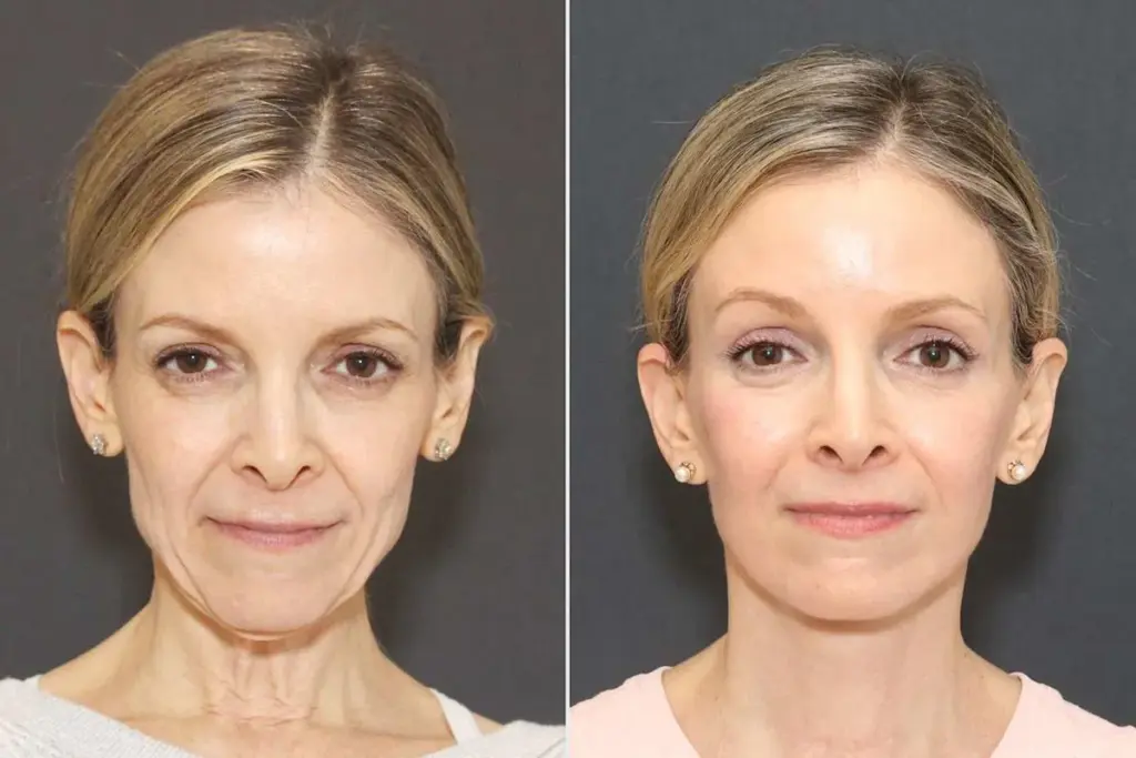 Ol Der Health: Amazing Surgery Success Tips