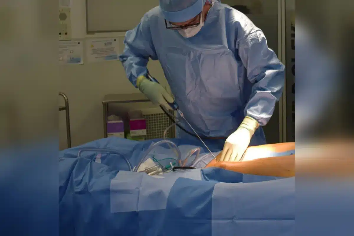 Shoulder operations recovery time Tips For Vital Comfort