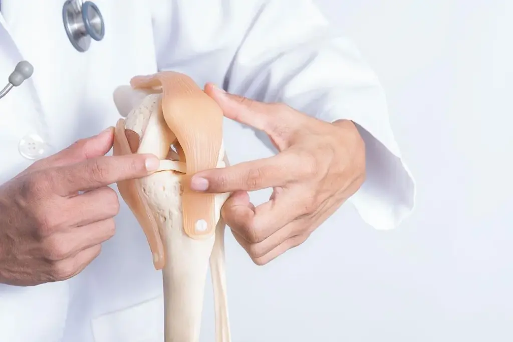 Knee Replacement Xray: Amazing Diagnostic Tool