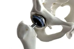 How Long After Suppository Can I Poop Safely?