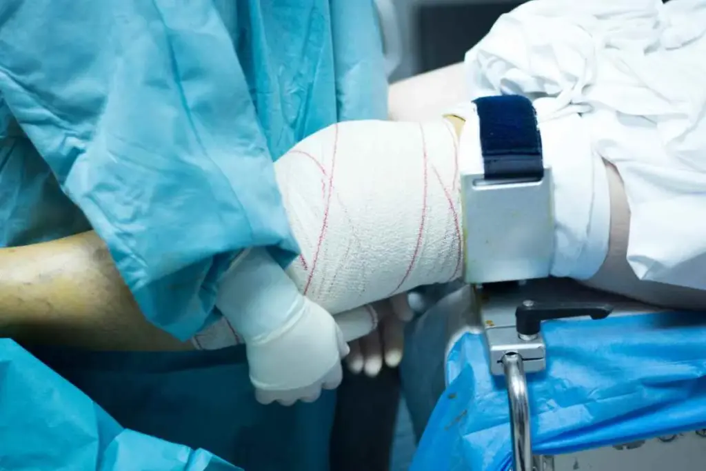 Knee Surgery How Long To Recover: Walk Fast 2 Understanding Knee Arthroscopy: A Minimally Invasive Procedure